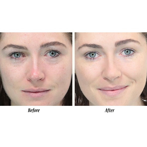 [Đại lí] Serum tái tạo và kích thích trẻ hóa da với AHA/PHA từ Tảo THALGO 30ml - Intensive Resurfacing Night Serum