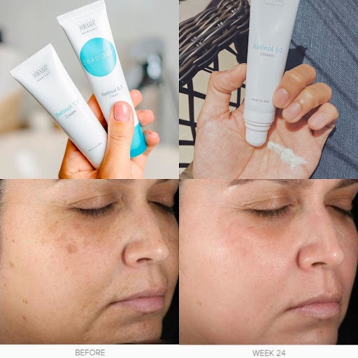 Kem Dưỡng Chống Lão Hóa, Ngăn Ngừa Mụn Obagi Medical Retinol Cream 0.5_ 28g