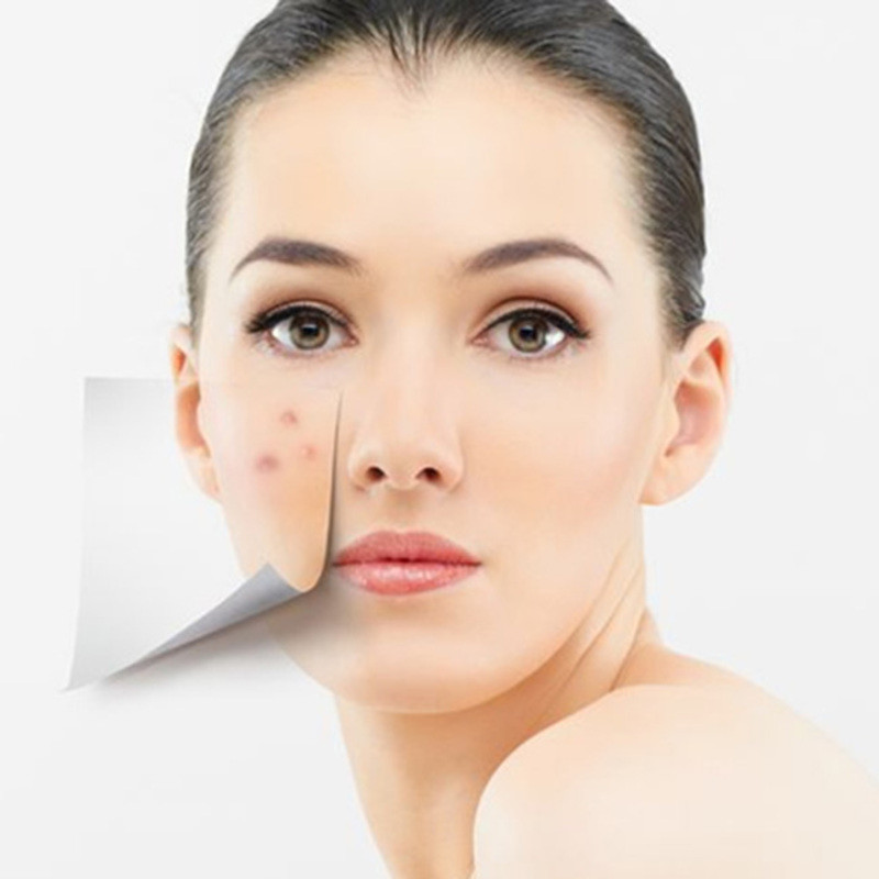 Imperfection Corrector - Tinh chất kháng viêm, ngăn ngừa nổi mụn