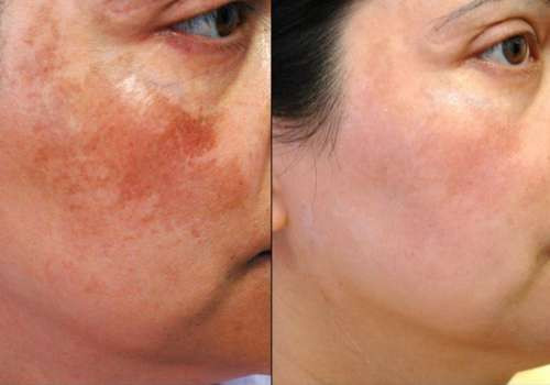SERUM LÀM SÁNG DA NGĂN NGỪA LÃO HÓA OBAGI PROFESSIONAL VITAMIN C SERUM 10%
