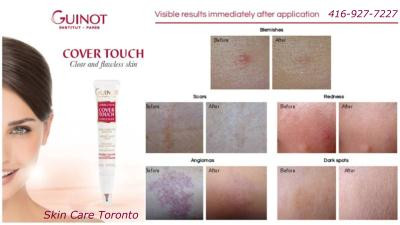Cover Touch Concealer - Kem điều trị mụn và che khuyết điểm