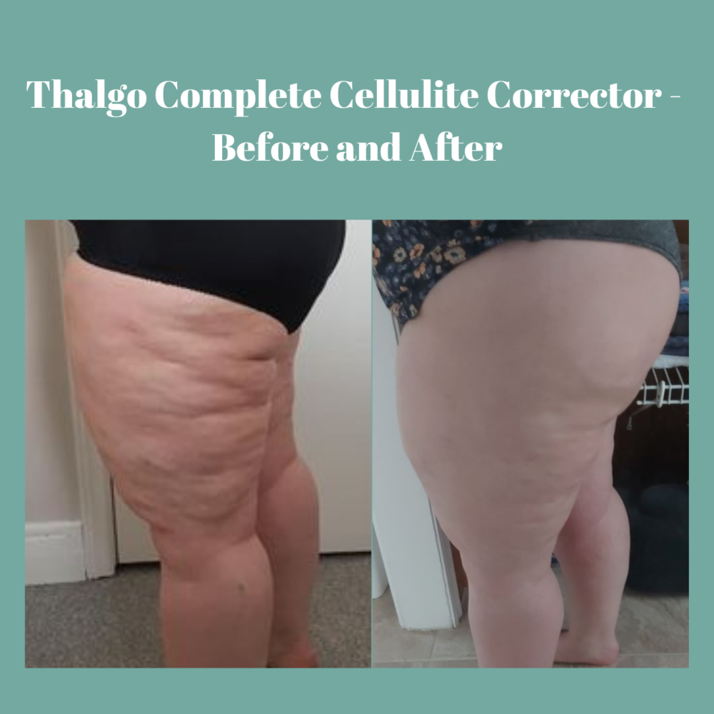 Complete Cellulite Corrector - Kem ngăn ngừa tích tụ mỡ sần da cam, làm da mịn màng