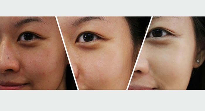 Kem Dưỡng Chống Lão Hóa, Ngăn Ngừa Mụn Obagi Medical Retinol Cream 1.0_ 28g