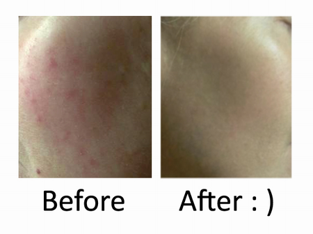 Sữa rửa mặt Paula’s Choice ngừa mụn, se khít lỗ chân lông 177ml - Pore Normalizing Cleanser