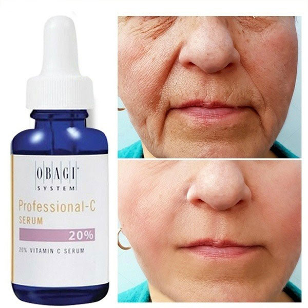 SERUM CHỐNG LÃO HÓA, GIẢM SẠM DA OBAGI PROFESSIONAL- C SERUM 20%