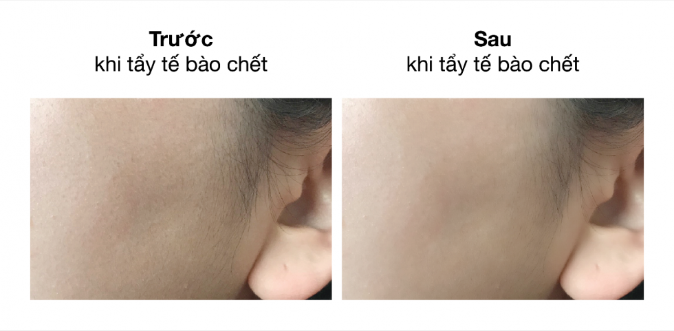 Lotion loại bỏ tế bào chết Paula's Choice Skin Perfecting 8% AHA Lotion 100ml